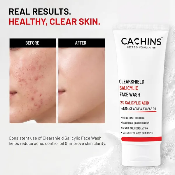 Salicylic_Acid_Face_Wash_With_Oat_Extract_And_Panthenol