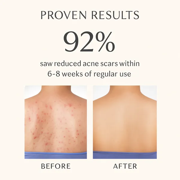 Salicylic_Acid_With_Vitamin_C_Body_Wash_For_Body_Cleansing