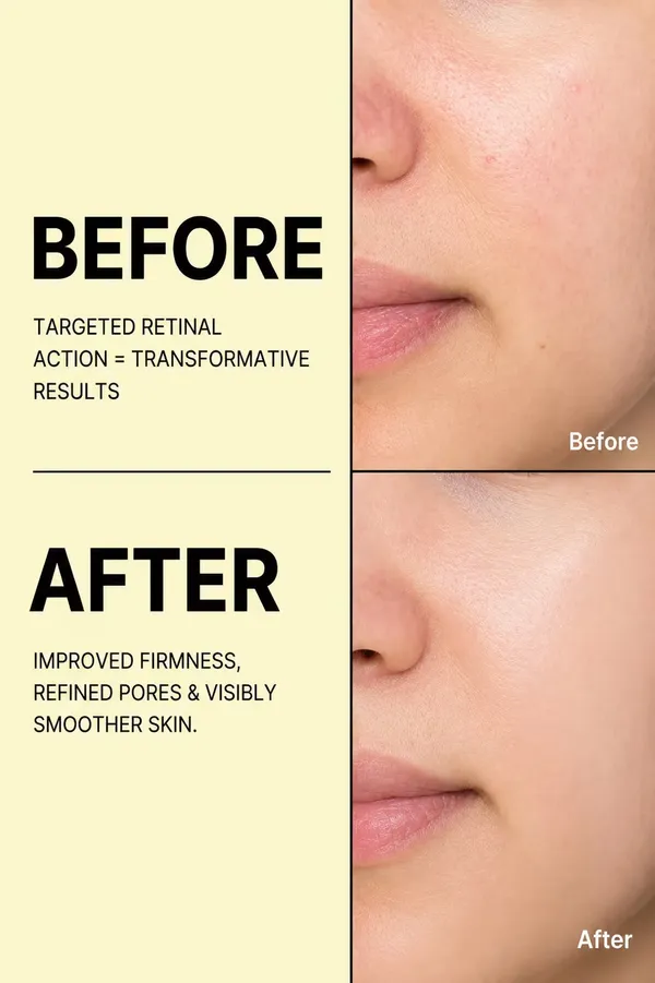 Celimax_Vita_A_Retinal_Shot_Ceramide_Tightening_Booster_Cream