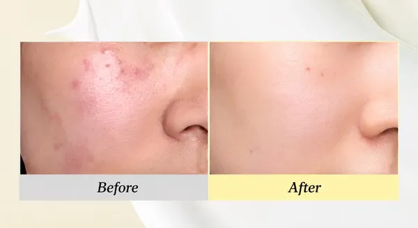 Dr_Althea_345_Relief_Cream_Hyaluronic_Acid_Ceramide_Barrier_Cream