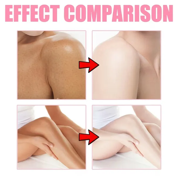 Aisasea_Niacinamide_Vitamin_C_Brightening_Body_Whitening_Cream
