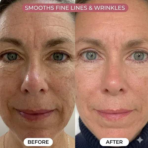 Pdrn_Pink_Collagen_Salmon_Peptide_Hydrating_Face_Mask