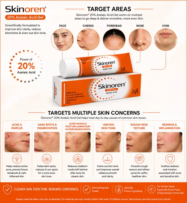 Skinoren_Azelaic_Acid_20%_Acne_&_Dark_Spot_Treatment_Cream