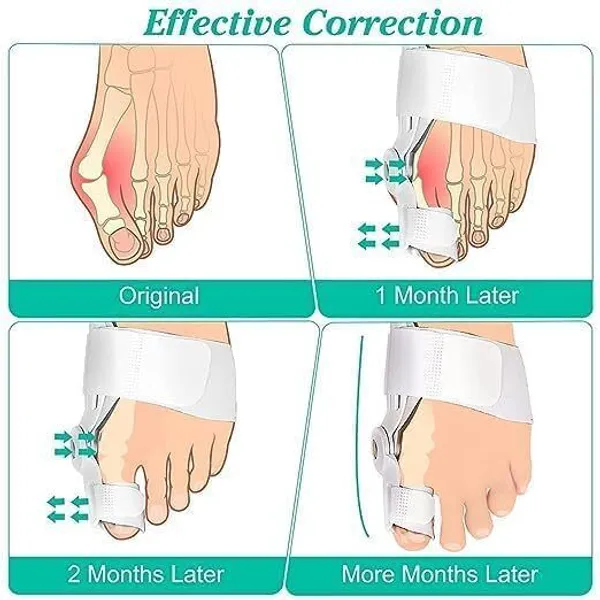 White_Medical_Grade_Silicone_Bunion_Corrector_For_Toe_Alignment_&_Bunion_Relief