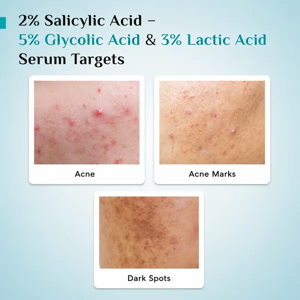 10%_Aha+Bha_Exfoliating_Face_Serum