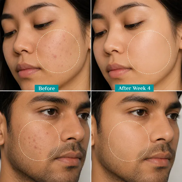 10%_Niacinamide_Face_Serum