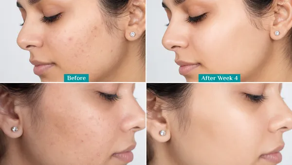 Vitamin_C_Face_wash_&_10%_Vitamin_C_Booster_Serum