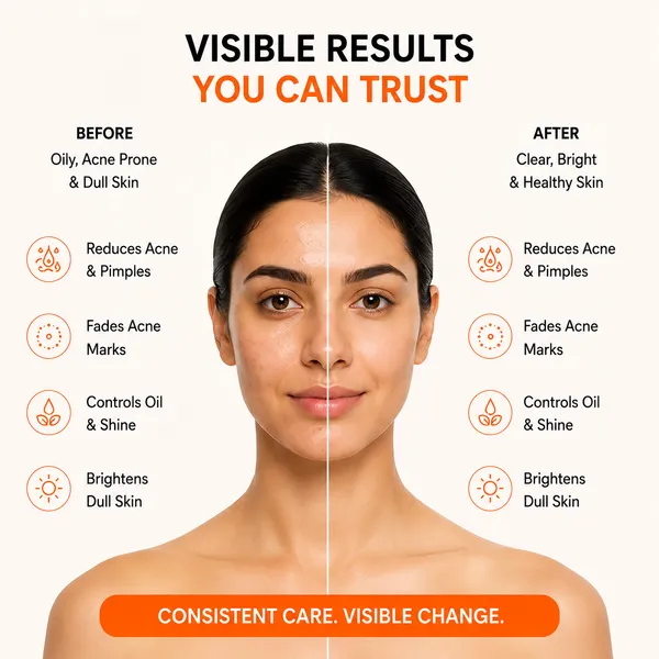 Skin_Molecule_Mandelic_Acid_Vitamin_C_Anti_Acne_Face_Wash