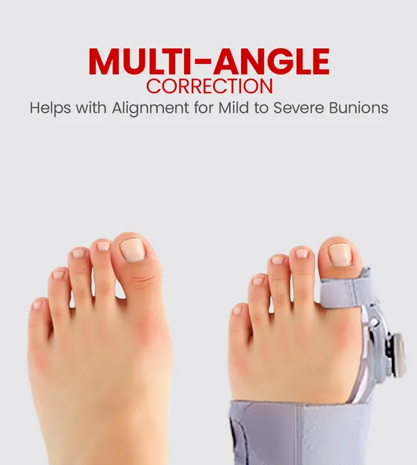 Ageasy_Bunion_Corrector_Realign_Your_Toe_Free_Toe_Exerciser