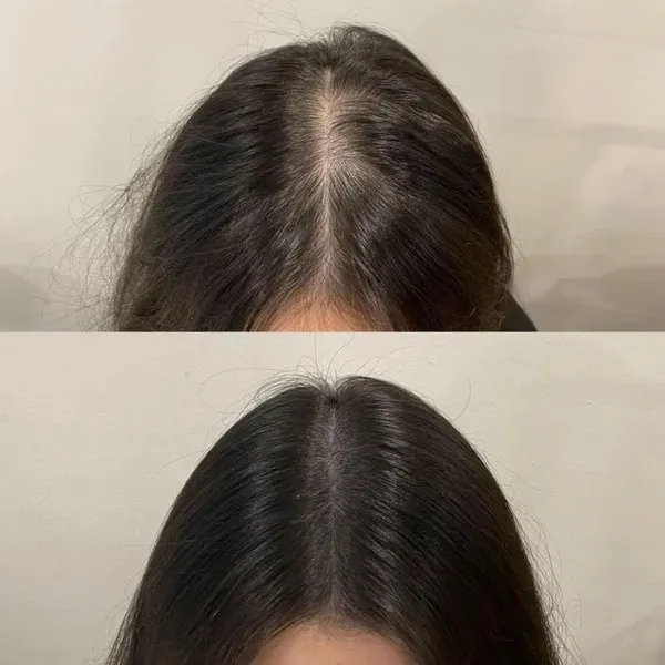 Ayurvedic_Hair_Oil_For_Hair_Care_Herbal_Nourishing_Hair_Oil_For_Men_And_Women_100_Ml