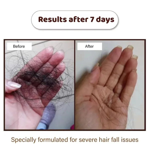 Ayurvedic_Hair_Oil_For_Hair_Care_Herbal_Nourishing_Hair_Oil_For_Men_And_Women_100_Ml