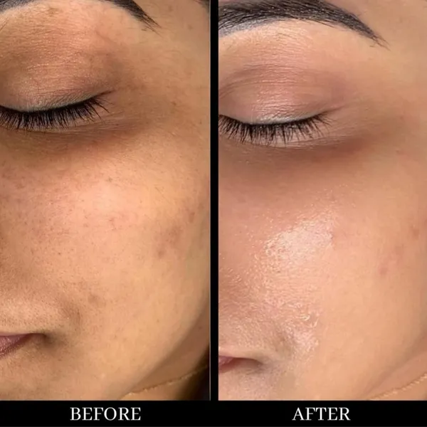Face_Cream_For_Skin_Care_Nourishing_Moisturizing_Cream_For_Men_And_Women_50_Grams