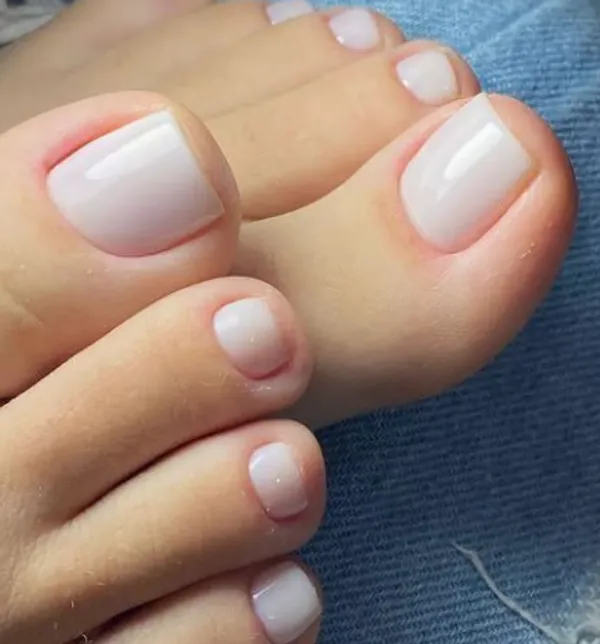 Milky_White_Toe_Nails