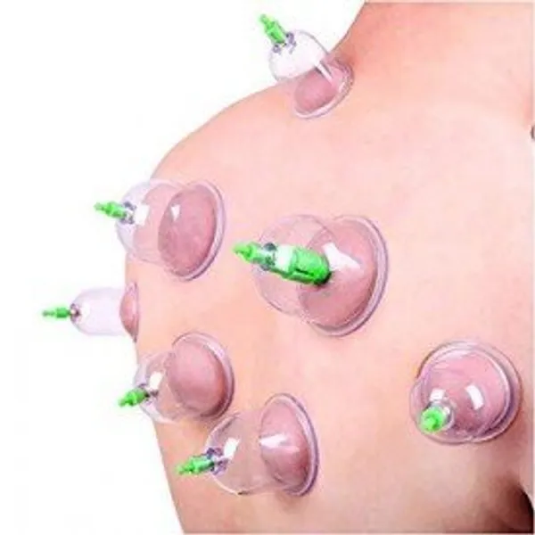Plastic_Vacuum_Cupping_Therapy_Set_24_Pcs