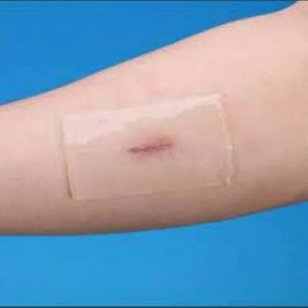 Albio_Silicone_Gel_Reusable_Scar_Removal_Patch_10X20Cm