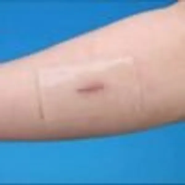 Albio_Silicone_Gel_Reusable_Scar_Removal_Patch_10X20Cm