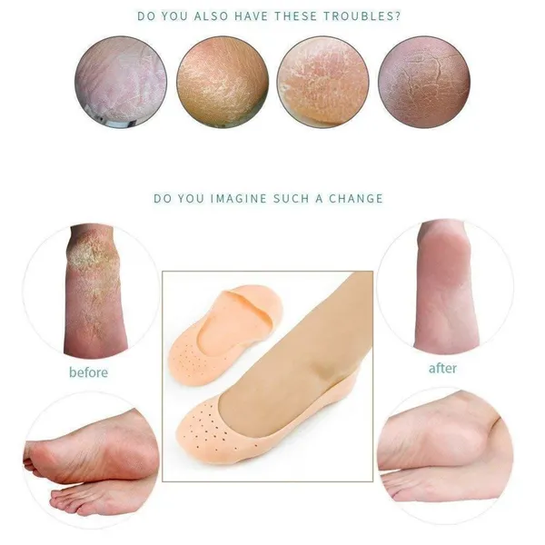 Silicone_Gel_Heel_Protector_Socks