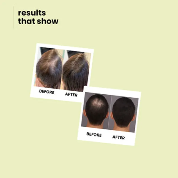 Freshluxe_Argan_Oil_Apple_Cider_Vinegar_Scalp_Repair_Shampoo