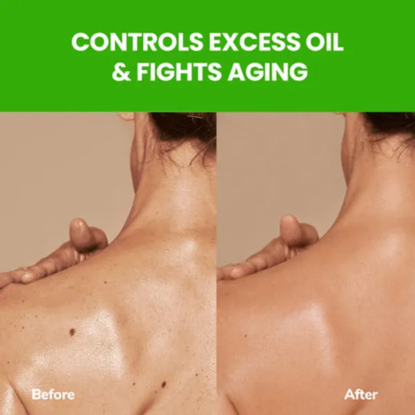 Freshluxe_Rain_Forest_Multani_Mitti_Glycerol_Oil_Control_Shower_Gel