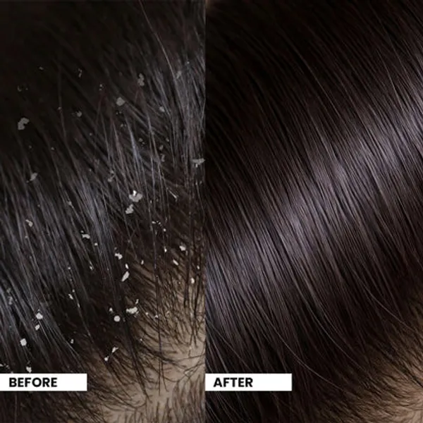 Freshluxe_Botanic_Balance_Neem_Aloe_Vera_Anti-Dandruff_Shampoo