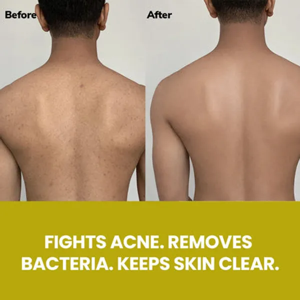 Freshluxe_Zen_Spa_Salicylic_Acid_Tea_Tree_Clarifying_Shower_Gel