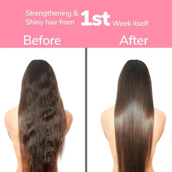 Freshluxe_Rice_Water_Onion_Rosemary_Anti-Hairfall_Strengthening_Combo_Pack_Of_2