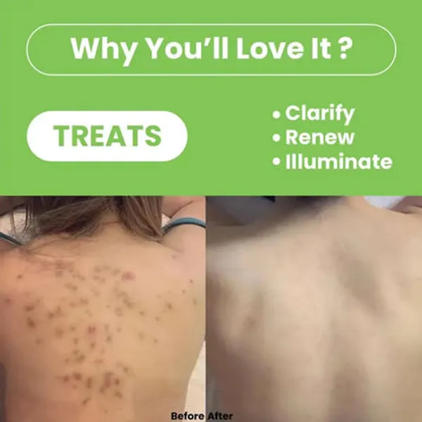 Freshluxe_Tea_Tree_Eucalyptus_Green_Tea_Scrub_&_Body_Wash_Combo_Pack_Of_2