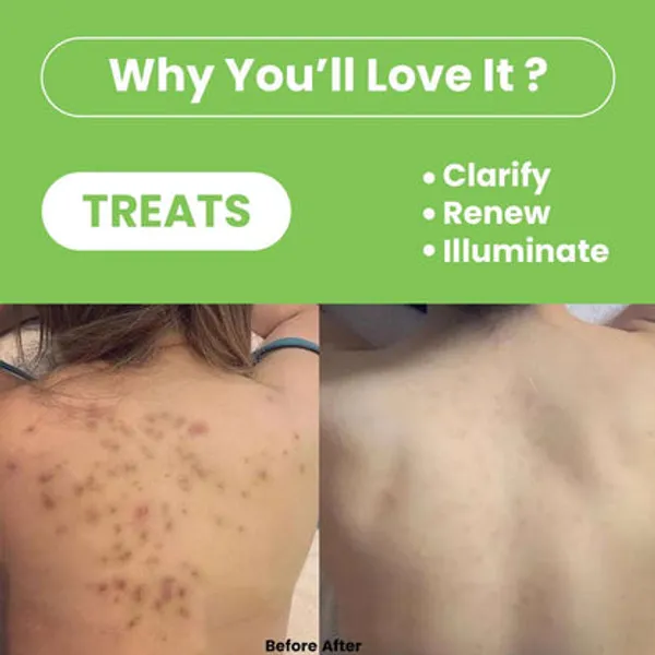 Freshluxe_Green_Tea_Neem_Oil_Shampoo_&_Scrub_Skincare_Combo_Pack_Of_2