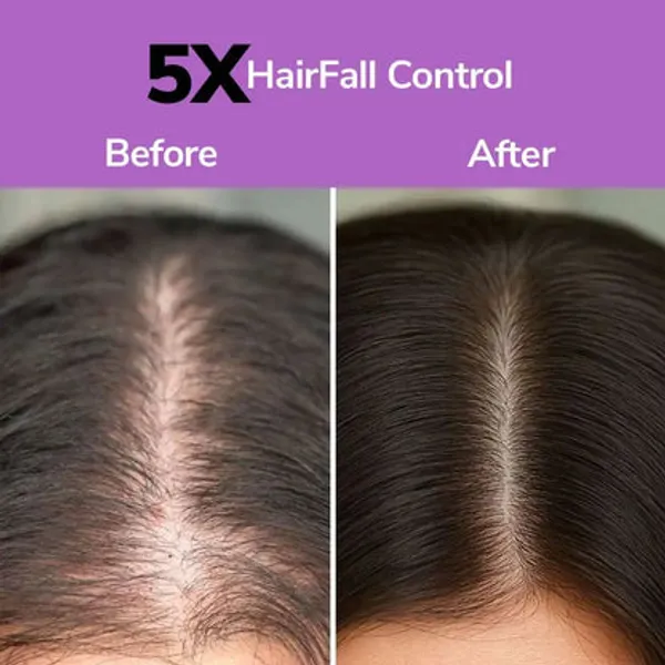 Freshluxe_Anti-Hairfall_Rice_Water_Onion_Rosemary_Shampoo_Combo