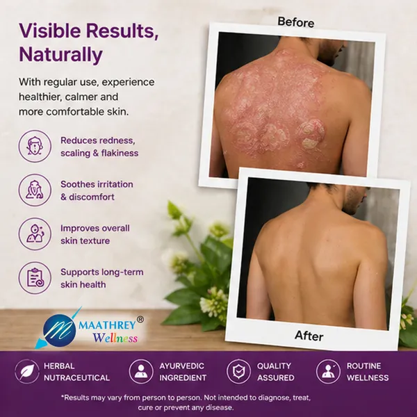 Sorfar_Sphaeranthus_Indicus_Extract_Tablets_For_Skin_Health