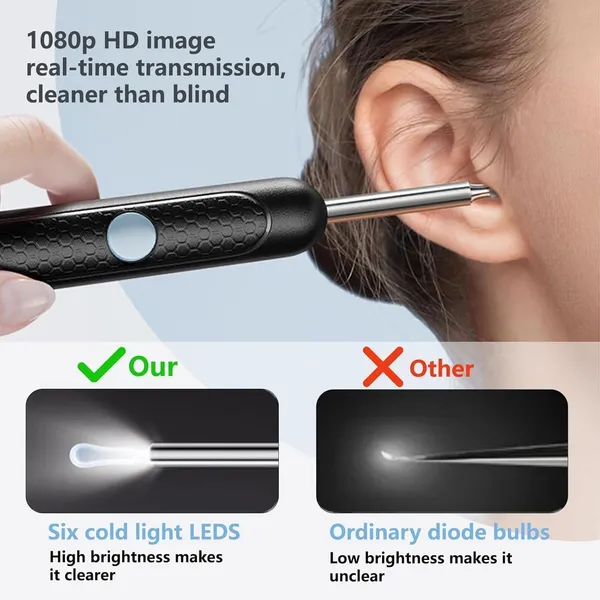 Ear_Wax_Removal_Kit_With_Camera_Light_Rechargeable_Ear_Cleaner_1080p_Hd_Ear_Otoscope_For_Kids_Adults_Compatible_With_Android_Ios_Devices