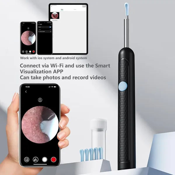 Ear_Wax_Removal_Kit_With_Camera_Light_Rechargeable_Ear_Cleaner_1080p_Hd_Ear_Otoscope_For_Kids_Adults_Compatible_With_Android_Ios_Devices