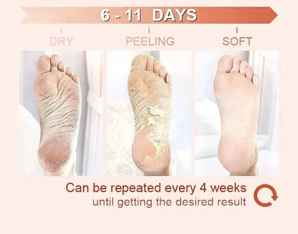 Feenec_Mart_Foot_Peel_Mask_1_Pack_Exfoliating_Foot_Mask_For_Dry_Cracked_Callused_Feet_Foot_Spa_Peeling_Mask_For_Men_Women_Dead_Skin_Heel_Repair_Treatment_Foot_Care_Moisturizer_Rose