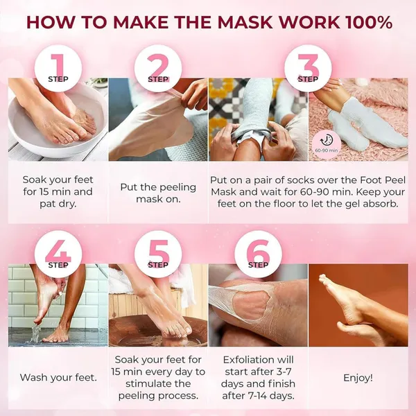 Feenec_Mart_Foot_Peel_Mask_1_Pack_Exfoliating_Foot_Mask_For_Dry_Cracked_Callused_Feet_Foot_Spa_Peeling_Mask_For_Men_Women_Dead_Skin_Heel_Repair_Treatment_Foot_Care_Moisturizer_Cherry