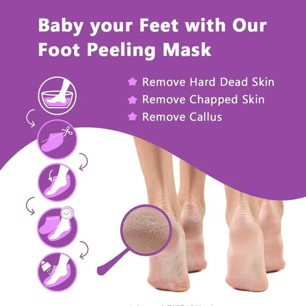 Feenec_Mart_Foot_Peel_Mask_1_Pack_Exfoliating_Foot_Mask_For_Dry_Cracked_Callused_Feet_Foot_Spa_Peeling_Mask_For_Men_Women_Dead_Skin_Heel_Repair_Treatment_Foot_Care_Moisturizer_Cherry