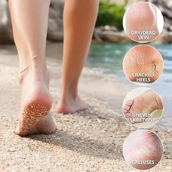 Feenec_Mart_Foot_Peel_Mask_1_Pack_Exfoliating_Foot_Mask_For_Dry_Cracked_Callused_Feet_Foot_Spa_Peeling_Mask_For_Men_Women_Dead_Skin_Heel_Repair_Treatment_Foot_Care_Moisturizer_Strawberry