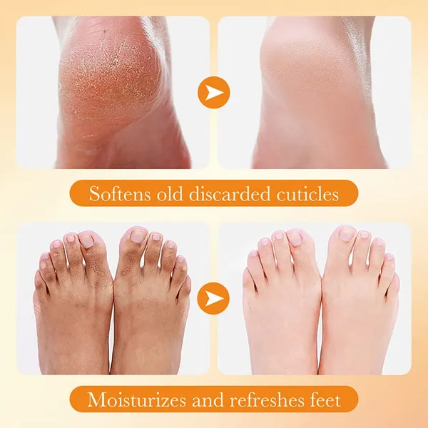 Feenec_Mart_Foot_Peel_Mask_1_Pack_Exfoliating_Foot_Mask_For_Dry_Cracked_Callused_Feet_Foot_Spa_Peeling_Mask_For_Men_Women_Dead_Skin_Heel_Repair_Treatment_Foot_Care_Moisturizer_Vitamin_C