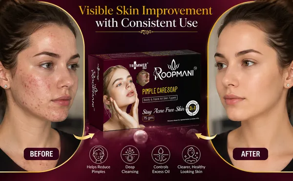 Pimple_Care_Soap_75_Gram