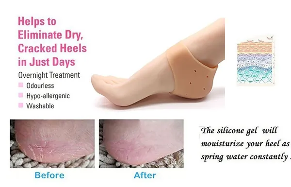 Silicone_Gel_Heel_Pad_Socks