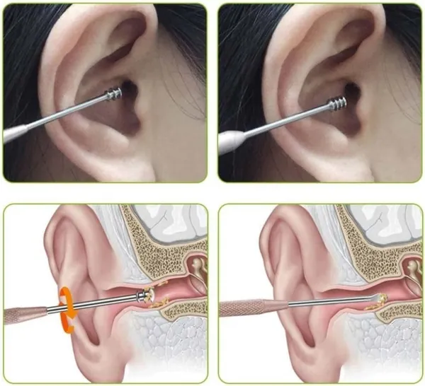 6_in_1_Ear_Wax_Cleaner_set
