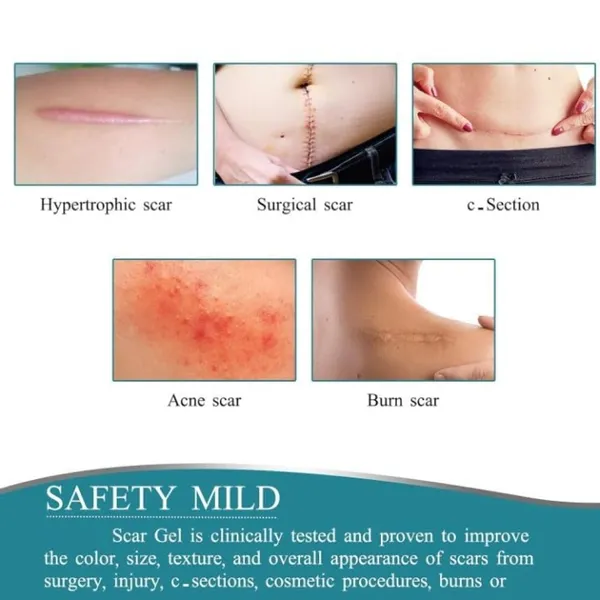 Silicone_Scar_Removal_Sheet