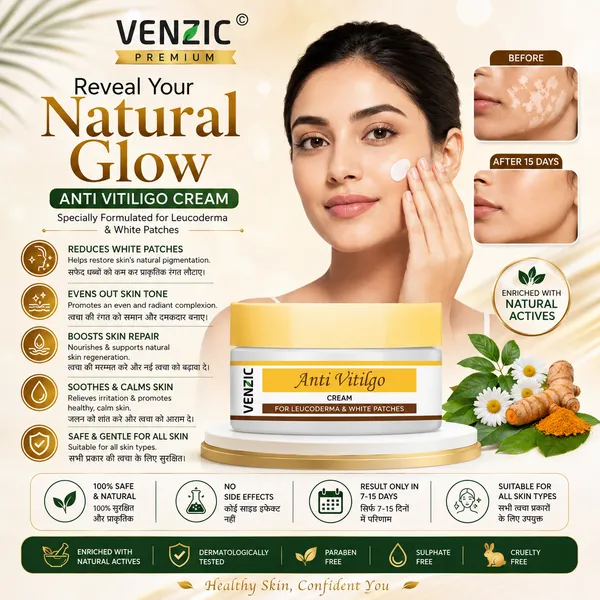 Venzic_Anti_Vitiligo_Cream_For_Leucoderma_And_White_Patches