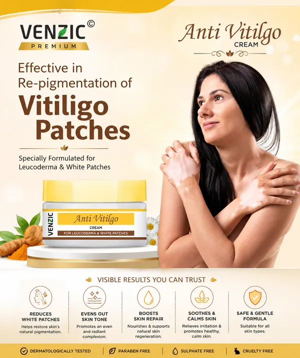 Venzic_Anti_Vitiligo_Cream_For_Leucoderma_And_White_Patches