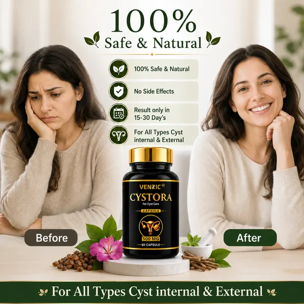 Venzic_Cystora_500_Mg_Capsules