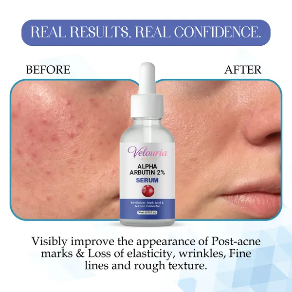Velouria_Beauty_Alpha_Arbutin_2_Serum_Dark_Spot_Texture_Corrector_Revitalizer_30_Ml