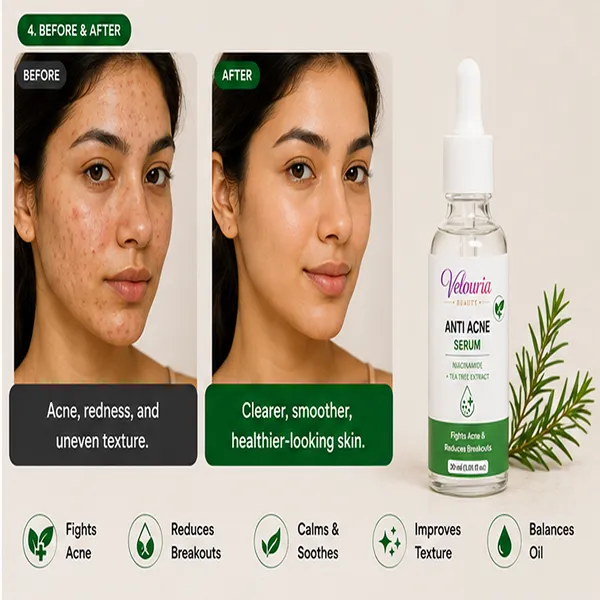 Velouria_Beauty_Anti_Acne_Face_Serum_Tea_Tree_Extract_Acne_Control_Pimple_Reduction_Serum_For_Men_Women_Lightweight_Oil_Control_Formula_30_Ml_Anti_Acne_Serum