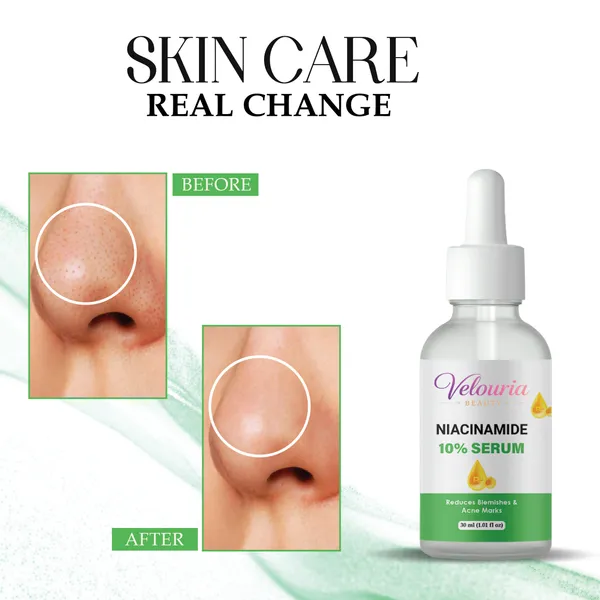 Velouria_Beauty_Niacinamide_10_Serum_Reduces_Blemishes_And_Acne_Marks_30_Ml