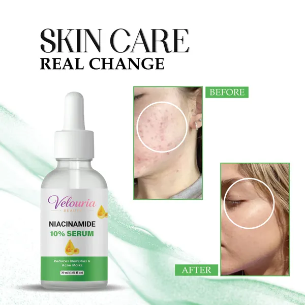Velouria_Beauty_Niacinamide_10_Serum_Reduces_Blemishes_And_Acne_Marks_30_Ml