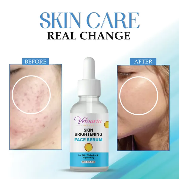 Velouria_Beauty_Skin_Brightening_Face_Serum_For_Dark_Spots_And_Uneven_Skin_Tone_30_Ml