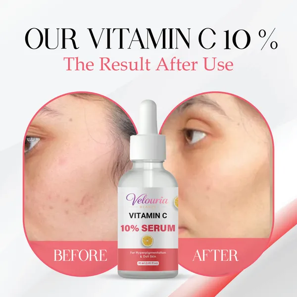 Velouria_Beauty_Vitamin_C_10_Serum_Dull_Skin_Blemish_Reduction_Unscented_30_Ml